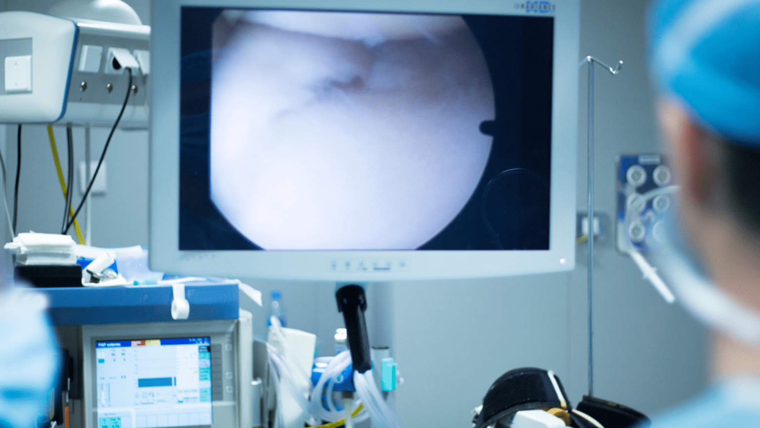 Exploring the Benefits and Procedure of Arthroscopic Surgery - Advanced ...