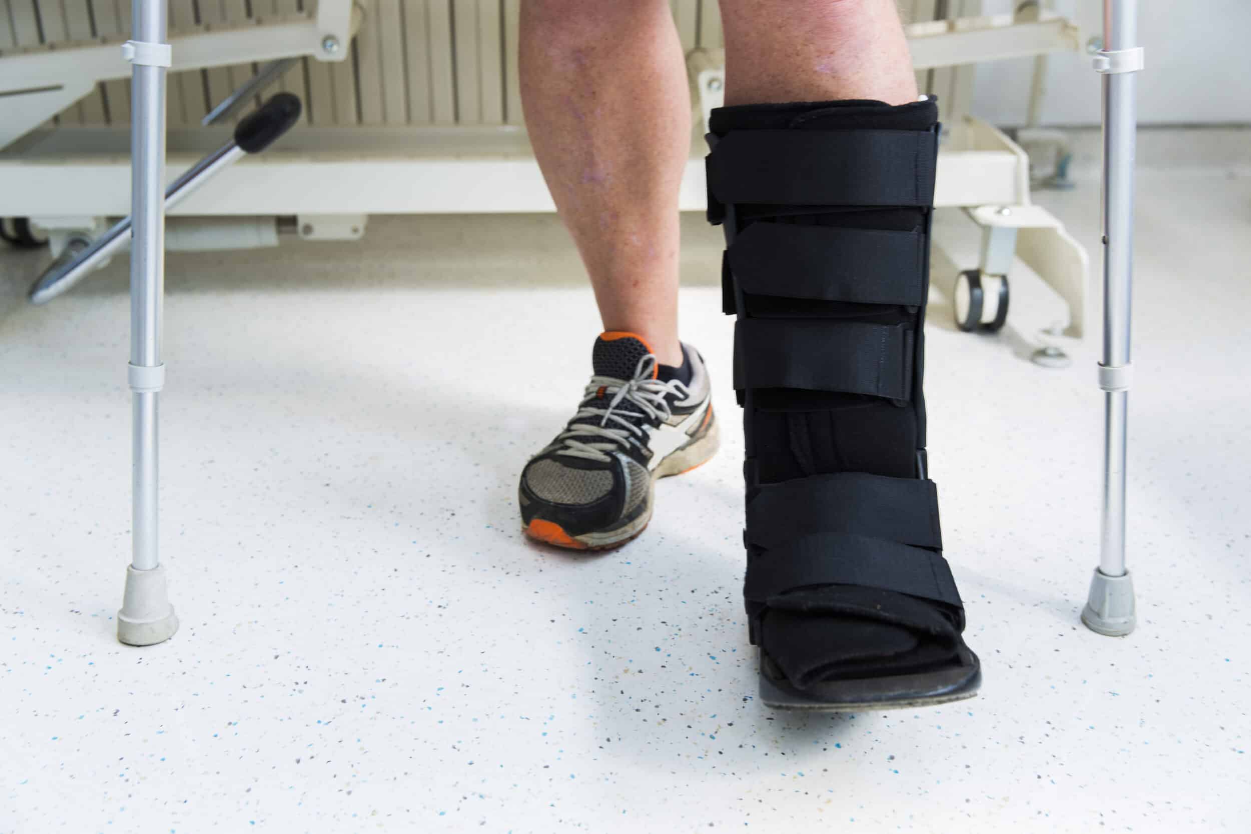 Man's leg, wearing a walking boot, after foot surgery